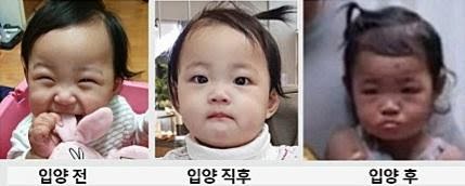 This collage of photographs depicts Jeong-ins gradual change in appearance before, right after, and during her adoption.